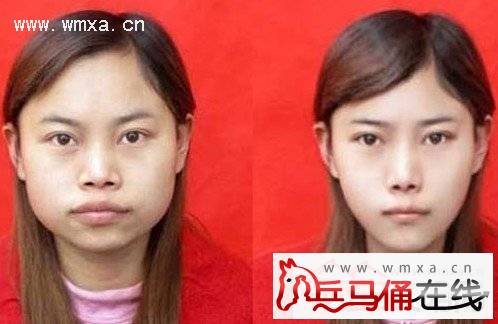 �����ô������ ���������ǰ��Ա���Ƭ