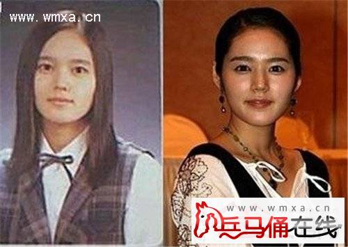  秋瓷炫整容 前后对比照曝光 秋瓷炫个人资料简