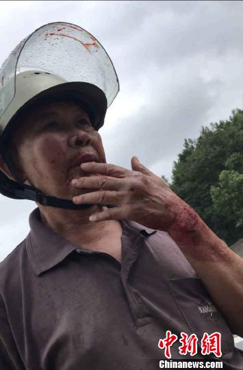 图为骑车摔倒后被救的六旬老人。连平警方供图