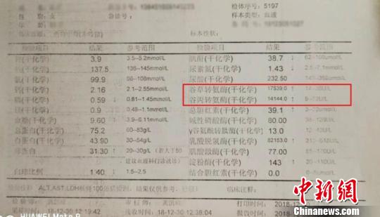 感冒药引发转氨酶数值爆表医生:对乙酰氨基酚成分损害肝脏