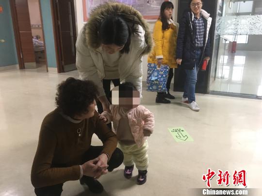 湖北一女婴被恶犬咬伤致全脸骨折