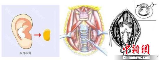 ַСȡıݣҰȫʽϸߡܷ 